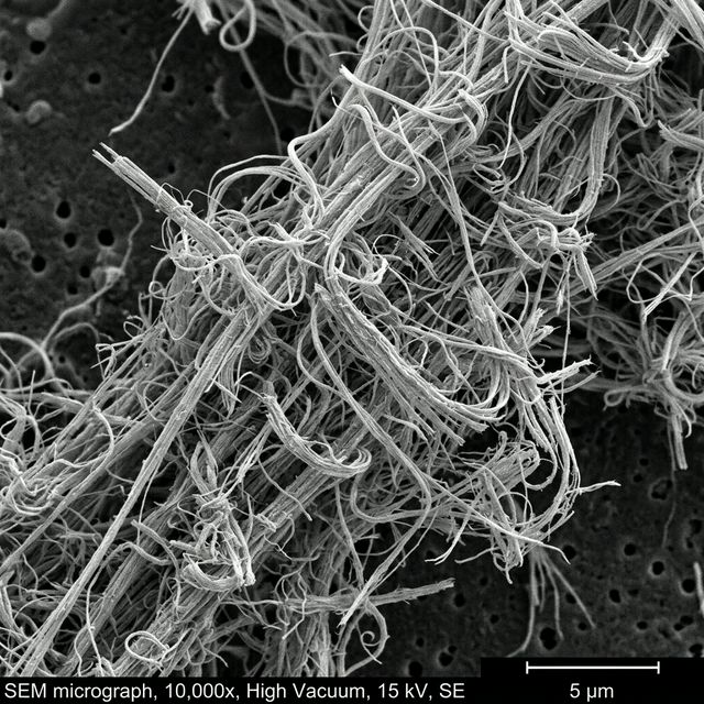 Microscopic view of asbestos fibers